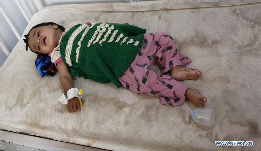 YEMEN-SANAA-CHILDREN-MALNUTRITION